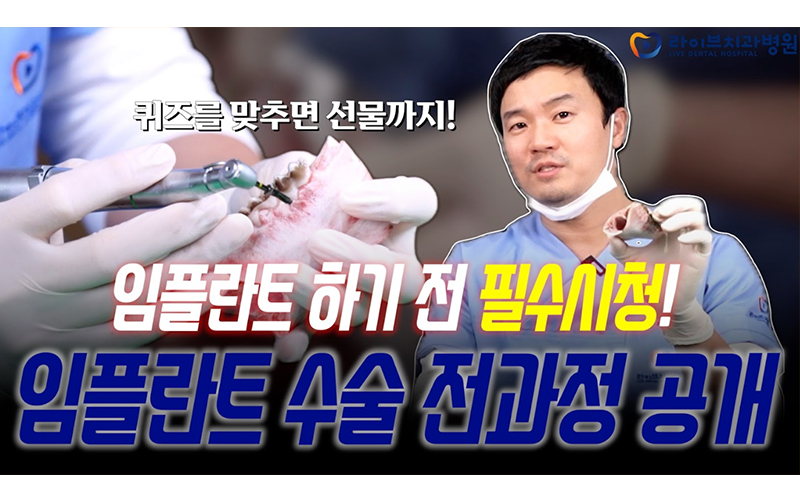 진짜 리얼 임플란트 식립 과정 그대로 보여드립니다